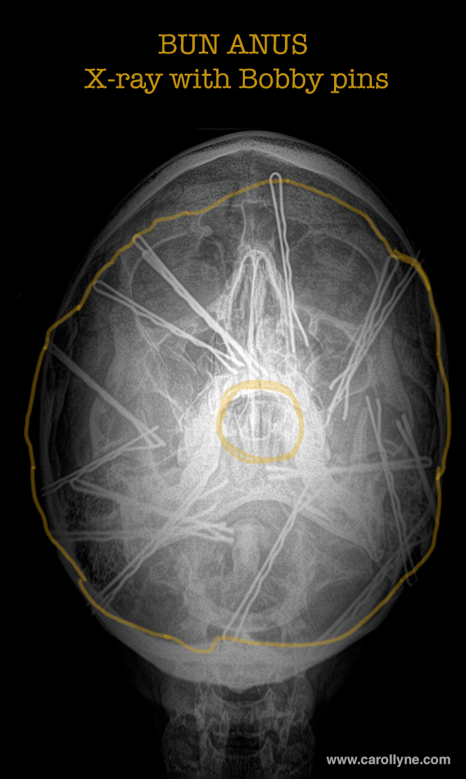 Bun Anus X-ray. Yeah, that's right, who else do you know that has an X-ray of their hair bun. Suck on that, my friends. xo